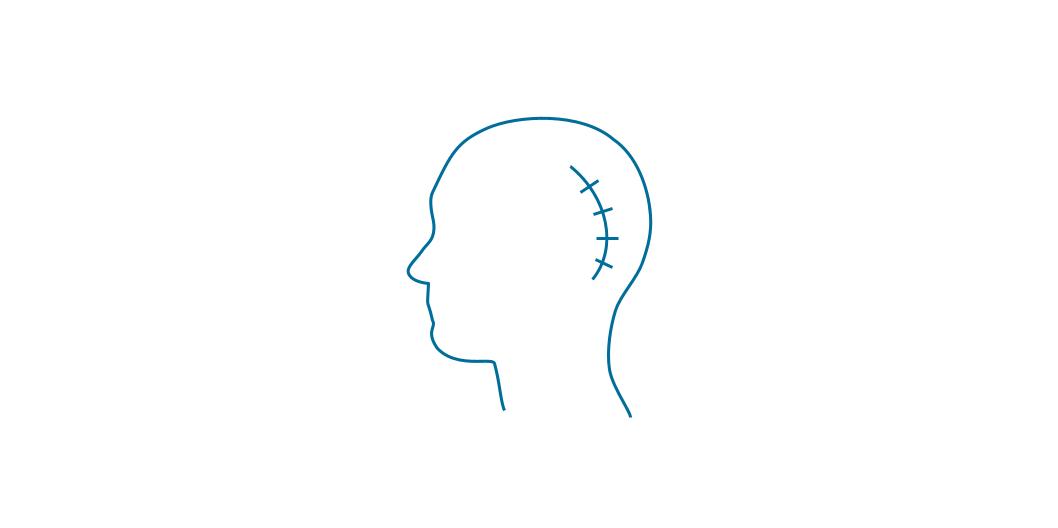 МЕДИЦИНСКИ СТАНДАРТ НЕВРОХИРУГИЯ